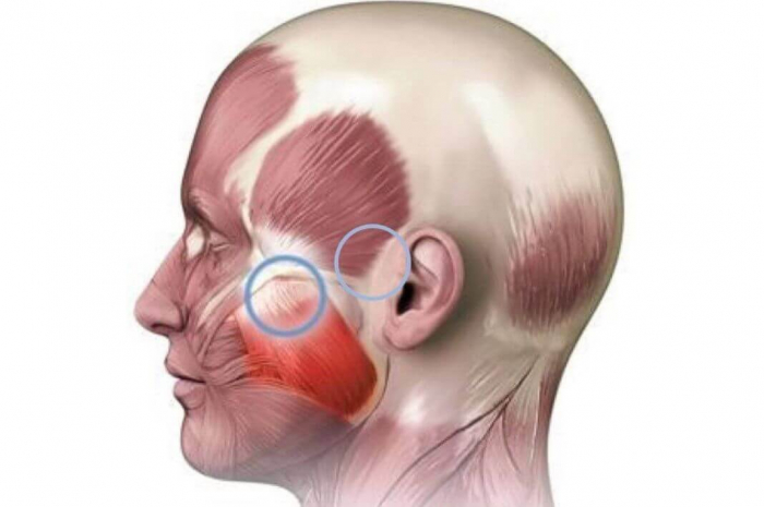 Жевательные мышцы — как избавиться от гипертонуса, спазма.